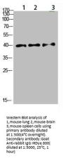 TPM1 Antibody