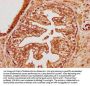 TRIM65 Antibody
