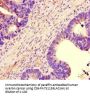 NBEAL2 Antibody