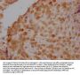 IKBIP Antibody
