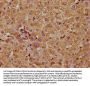 TAOK1 Antibody