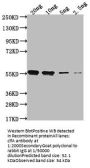 clfA Antibody