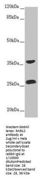 RAB12 Antibody