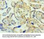 TTBK2 Antibody