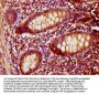 PNCK Antibody