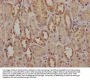 GBE1 Antibody