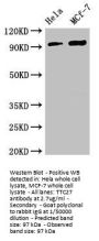 TTC27 Antibody