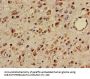 TTC27 Antibody