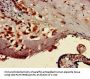 TTC27 Antibody