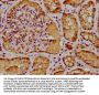 BRAT1 Antibody