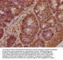 BRAT1 Antibody