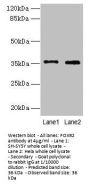 FOXR2 Antibody