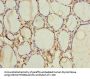 FOXR2 Antibody