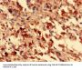FOXR2 Antibody