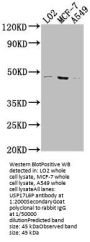 USP17L6P Antibody