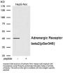 Phospho-ADRB2 (Ser346) Antibody