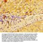 MACC1 Antibody