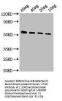 VP40 Antibody