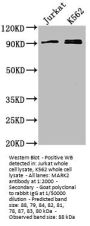 MARK2 Antibody