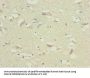 TTLL7 Antibody