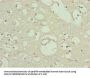 TTLL7 Antibody