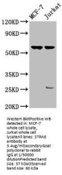 STRA8 Antibody