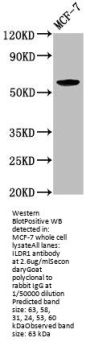 ILDR1 Antibody