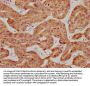 ILDR1 Antibody