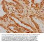 ILDR1 Antibody