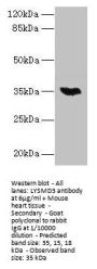 LYSMD3 Antibody