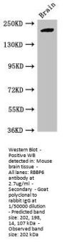 RBBP6 Antibody