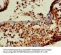 RBBP6 Antibody