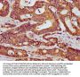 HOOK3 Antibody