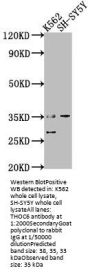 THOC6 Antibody