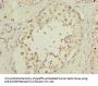 OOSP2 Antibody