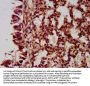 NLRC5 Antibody