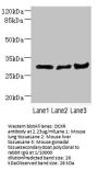 DCXR Antibody