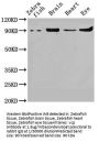 vcp Antibody