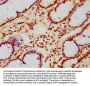PHLDB1 Antibody