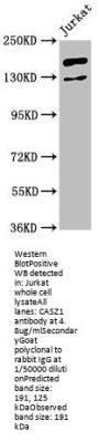 CASZ1 Antibody