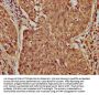 CASZ1 Antibody
