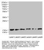 C5orf24 Antibody