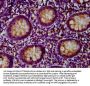 PNPLA5 Antibody
