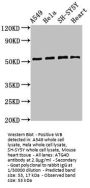 ATG4D Antibody