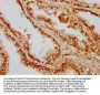 CAND1 Antibody