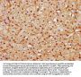 CAND1 Antibody