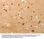 TNN Antibody