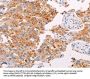 PLIN2 Antibody