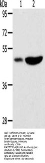 PLIN2 Antibody