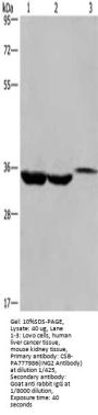 Rabbit anti-human ING2 polyclonal antibody